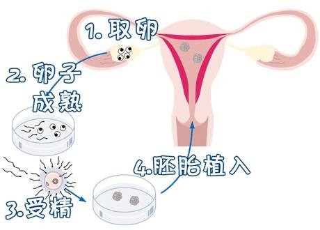 人工孕妈代怀助孕咨询怎么选
